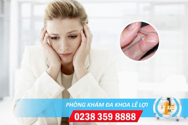 Địa chỉ điều trị bệnh huyết trắng ở nữ an toàn và hiệu quả hiện nay