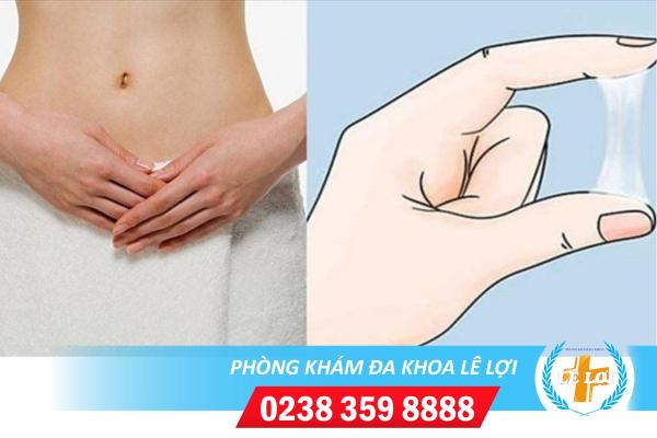 Điểm danh những nguyên nhân bệnh huyết trắng ở nữ