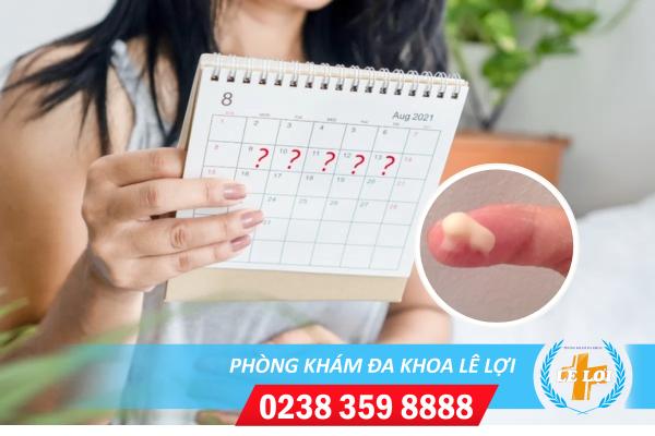 Nguyên nhân chậm kinh và ra nhiều huyết trắng ở nữ giới