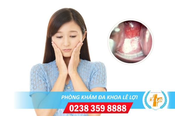 Huyết trắng có bọt và những nguyên nhân thường gặp