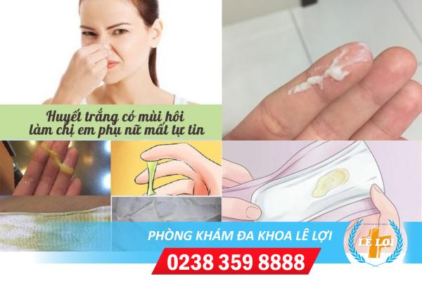 Điều trị huyết trắng hôi bằng cách nào?