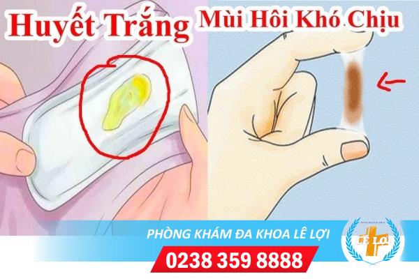 Cách chữa khí hư huyết trắng hiệu quả hiện nay