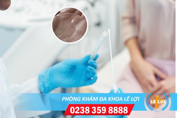 Điều trị huyết trắng lỏng ở đâu hiệu quả?