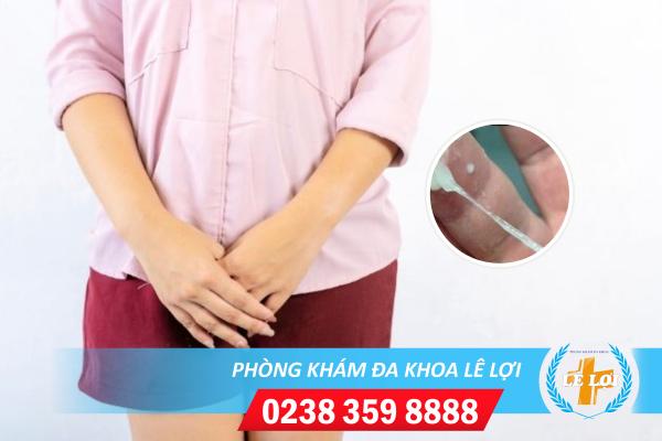 Nguyên nhân bị máu trắng thường gặp ở nữ giới