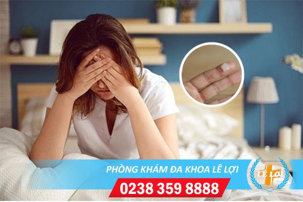 Huyết trắng đục và ngứa là bị bệnh gì?