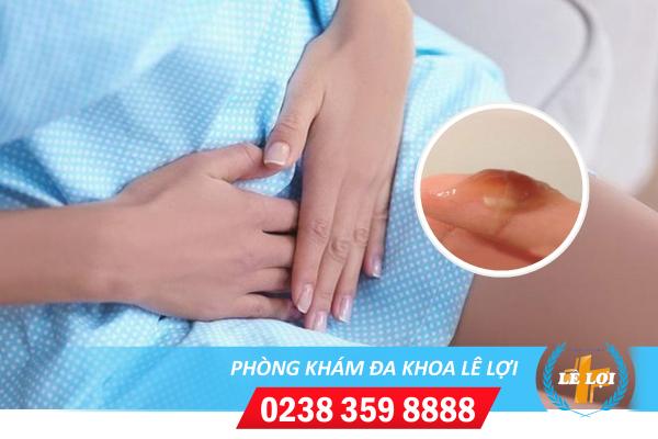 Ra Dịch Âm Đạo Màu Nâu Ở Phụ Nữ Có Sao Không