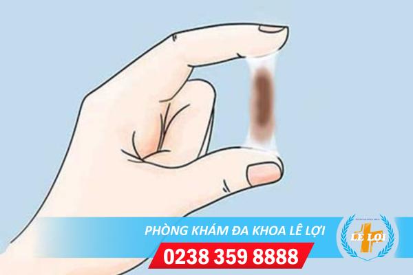 Hiện tượng huyết trắng có màu nâu là bị gì?