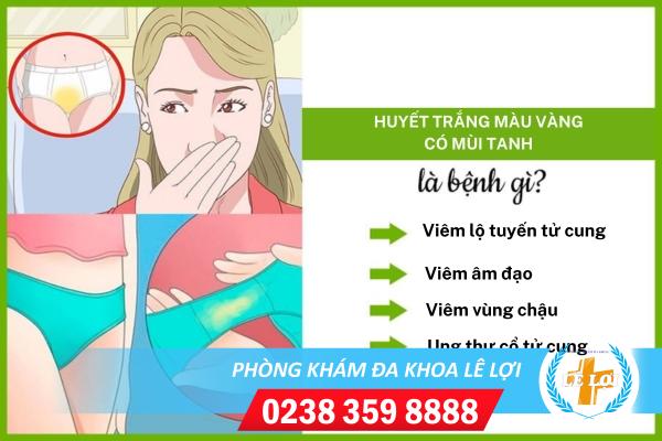 Những ảnh hưởng khi ra huyết trắng màu vàng có mùi tanh