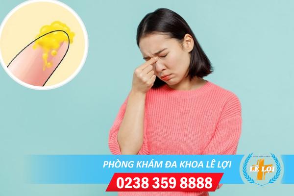 Tác hại nguy hiểm của tình trạng huyết trắng có màu vàng và ngứa