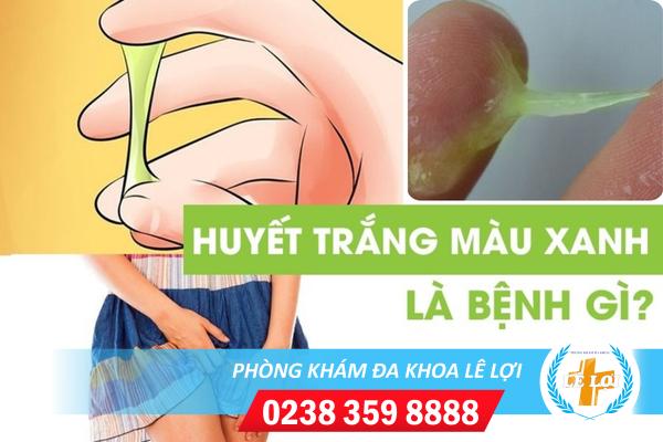 Một số lưu ý khi gặp tình trạng huyết trắng màu xanh