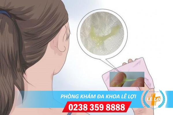 Phòng khám chữa huyết trắng ra nhiều có màu xanh nhạt hiệu quả hiện nay