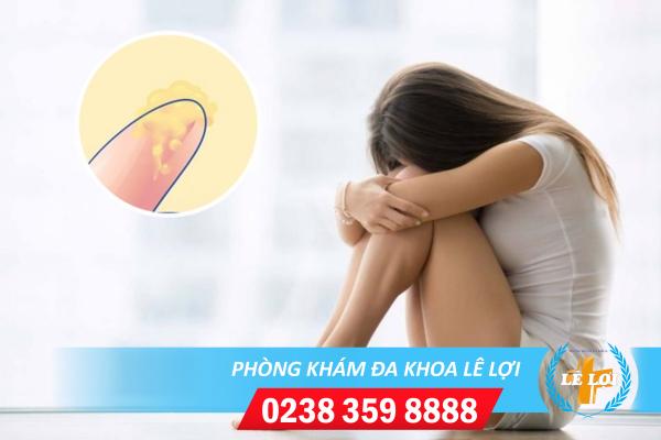 Những vấn đề cần lưu ý gặp hiện tượng ngứa vùng kín chảy dịch vàng