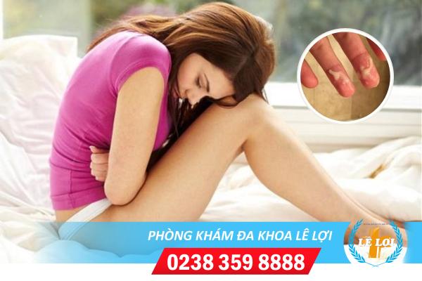 Ngứa âm đạo ra huyết trắng đục và một số vấn đề cần lưu ý