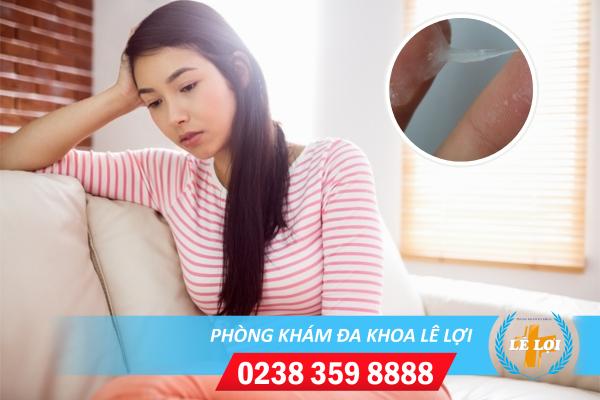 Ngứa vùng kín ra nhiều huyết trắng và những nguyên nhân thường gặp