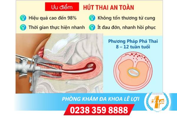 Nạo hút thai không đau tại Phòng khám Lê Lợi