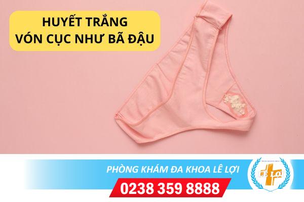 Huyết trắng bã đậu là do đâu?