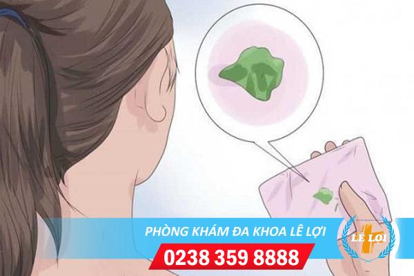 Tìm hiểu nguyên nhân huyết trắng màu xanh như bã đậu