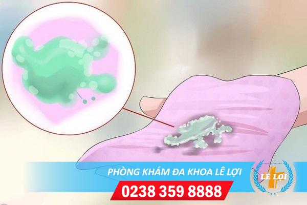 Cách trị huyết trắng màu xanh hiệu quả