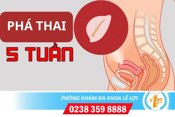 Phá thai 5 tuần tuổi có được không?