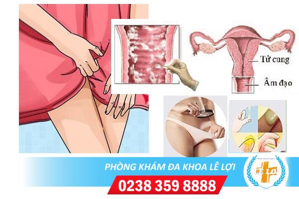 Viêm âm đạo sau khi sinh và phương pháp điều trị