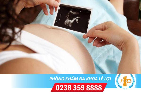 Nguyên nhân khiến dị tật thai nhi và cách khắc phục hợp lý