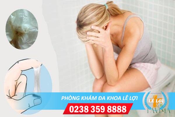 Sau quan hệ bị ngứa và ra huyết trắng phải làm sao?