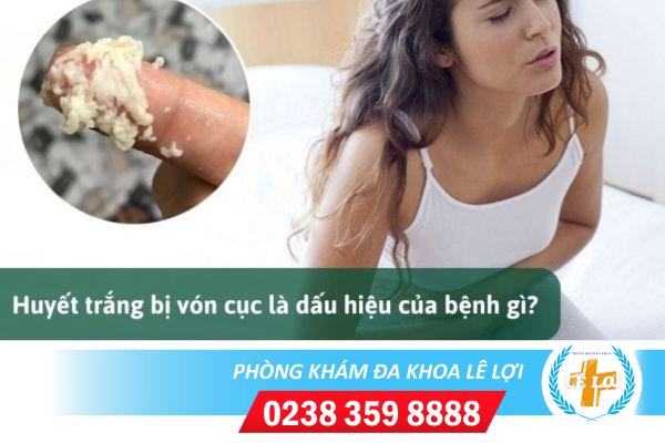 Quan hệ ra huyết trắng vón cục có nguy hiểm gì không?