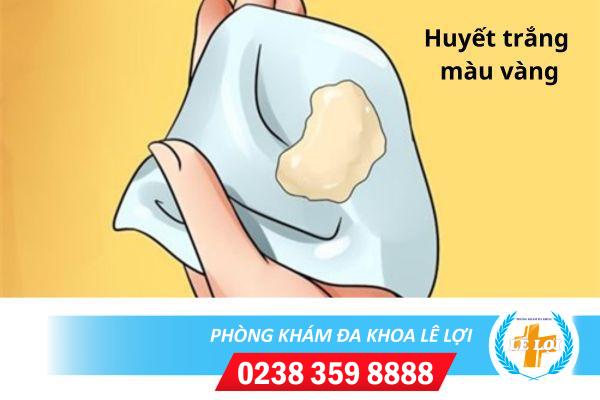 Huyết trắng có màu vàng là bệnh gì? cách chữa trị hiệu quả