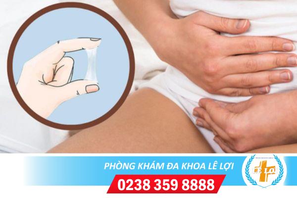 Chữa ra huyết trắng đục khi quan hệ ở đâu hiệu quả?