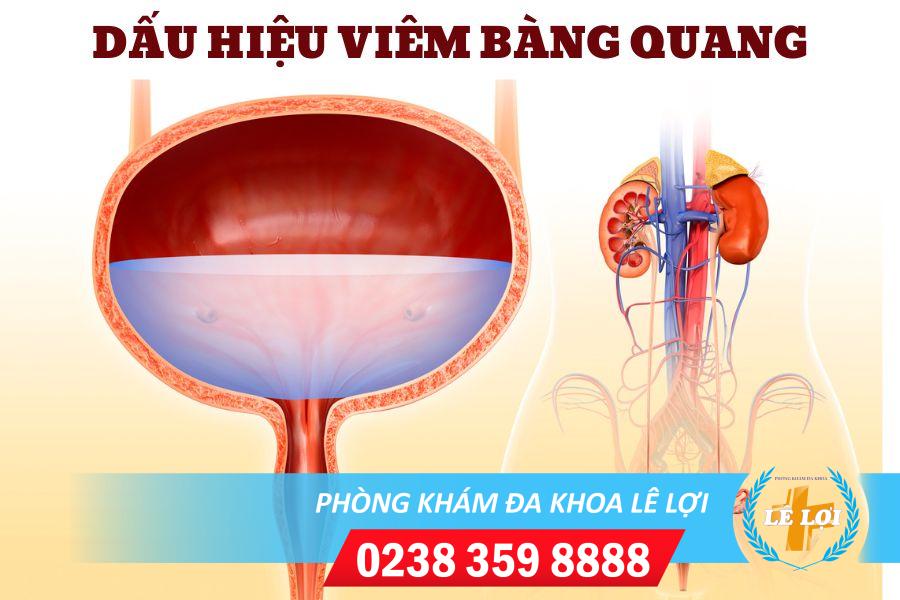 Những vấn đề xoay quanh viêm bàng quang ở nữ giới