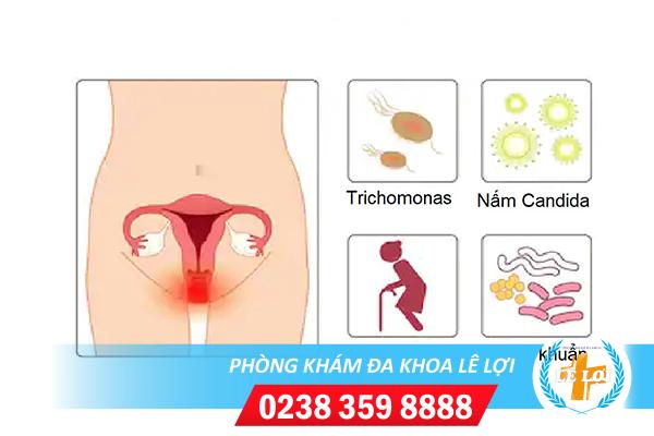 Nhiễm trùng âm đạo điều trị ngay khi có triệu chứng ban đầu