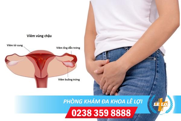 Viêm vùng chậu là gì