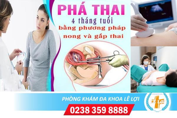 Phá thai 4 tháng tuổi và những điều cần biết