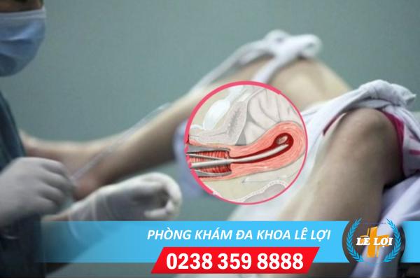 Tác hại hút thai rẻ tiền, kém chất lượng